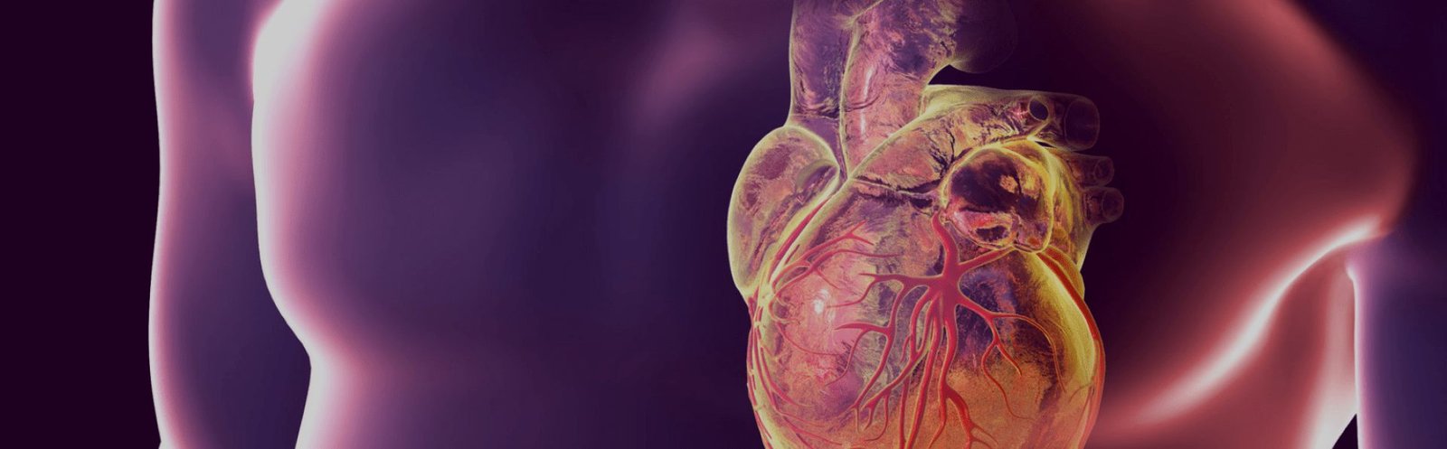 Aneurisma e Dissecção da Aorta